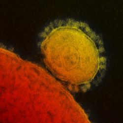 Electron micrograph of MERS virus particle (yellow) binding to a cell (orange)